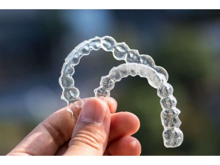 Clear aligners by Invisalign